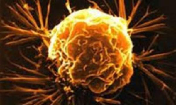 سرطانی که ادرارتان را خونی می کند سرطانی که ادرارتان را خونی می نماید